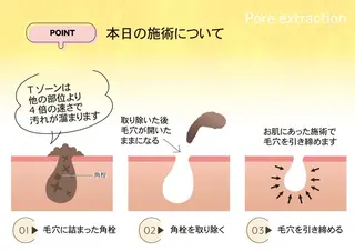 【毛穴専門店】 瑞江|yukaのエステ・リラクイメージ