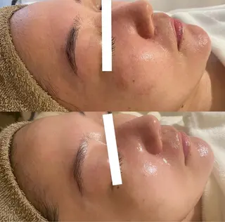 中目黒ハーブピーリン グ🌿ララピールのエステ・リラクイメージ