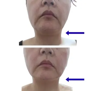 脂肪冷却/美肌改善 COCOKARAのエステ・リラクイメージ