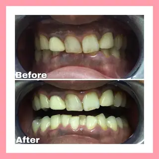 Briller 浜松のエステ・リラクイメージ