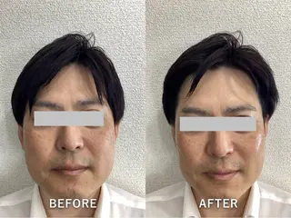 Recellage リセラージュのエステ・リラクイメージ