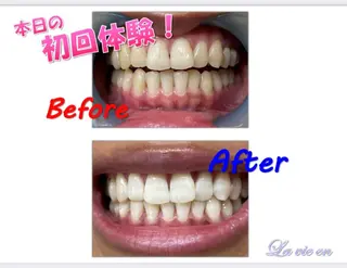 ホワイトニングサロン La vie enのその他イメージ