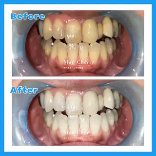 Mon Cheri 広島店のエステ・リラクイメージ