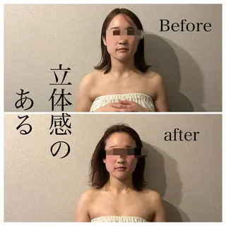 圧倒的たるみ改善 美容鍼エステのエステ・リラクイメージ