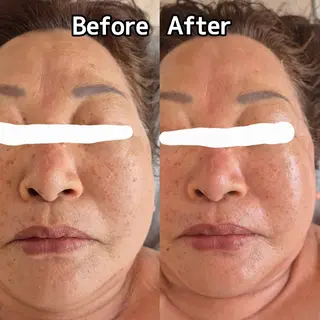 FERNABELL所属・岩本 ひなののエステ・リラクイメージ