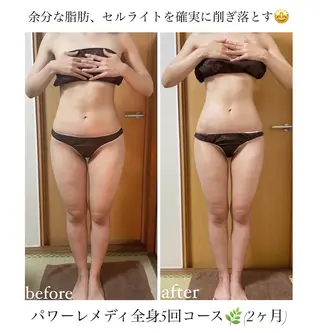 《本気痩せ×疲労改善 》  BILOOPのエステ・リラクイメージ