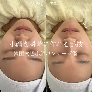 etre - 韓国肌管理 -のエステ・リラクイメージ