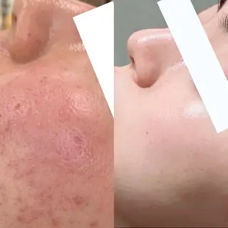 リラクゼーション サロンエアリーのエステ・リラクイメージ