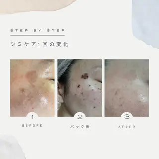 INFINITY 神戸店のエステ・リラクイメージ