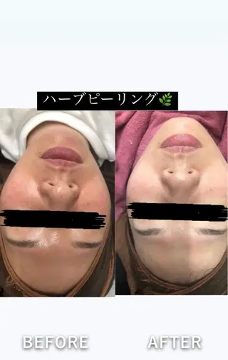 痩身・脱毛・肌管理 Rechica心斎橋のエステ・リラクイメージ