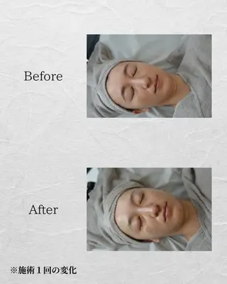 ハーブピーリング🌿 REVI/Ayanoのエステ・リラクイメージ