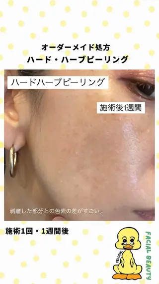 yellow💛【 脱毛&フェイシャル】のエステ・リラクイメージ