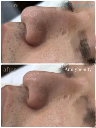 Amily beauty 毛利のエステ・リラクイメージ