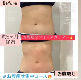 ブライダル痩身×脱毛 尼崎駅前サロンのエステ・リラクイメージ