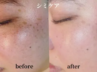 KA PILINAのエステ・リラクイメージ