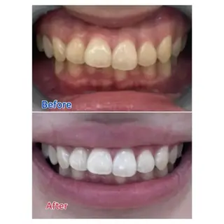 M渋谷 ホワイトニングのエステ・リラクイメージ