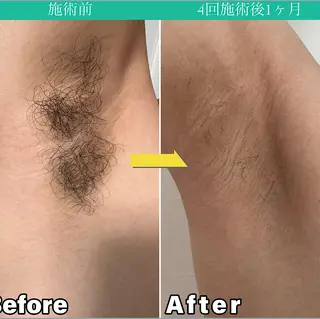 メンズ JONRY所属・JONRY （ジョンリー）のエステ・リラクイメージ