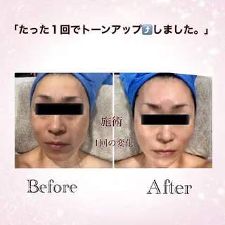 Total Beauty  ラトゥール所属・ラトゥール Maiのエステ・リラクイメージ