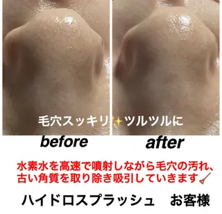 ネイル・エステサロン UILANIのネイルデザイン
