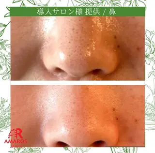 𝑟𝑖𝑛𝑎 🩵のマツエク・マツパデザイン