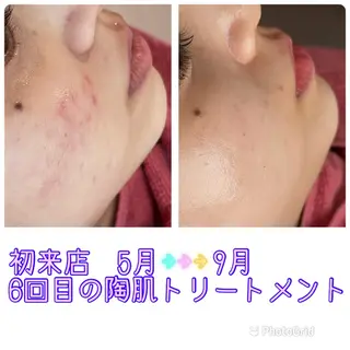 Dione八王子店所属・LUKE （ルーク）のエステ・リラクイメージ