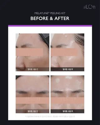 Luca 痩身• 疲労改善×韓国肌管理のエステ・リラクイメージ