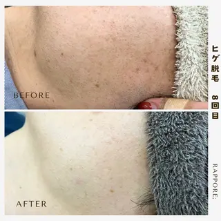 メンズ Rappore; 心斎橋　みずきのエステ・リラクイメージ