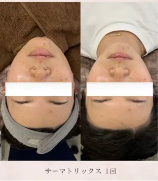 看護師が施術する美容 ナスサロshokoのエステ・リラクイメージ