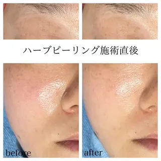 Kapua🌺 マユのマツエク・マツパデザイン