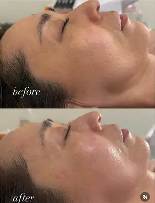 美容鍼灸サロン mahoroba院長のエステ・リラクイメージ