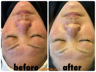 ÉMIA ✴︎のエステ・リラクイメージ