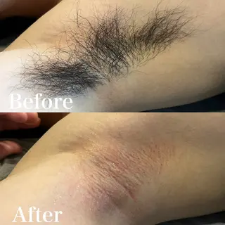 メンズ wax脱毛専門店 ハイラントのエステ・リラクイメージ