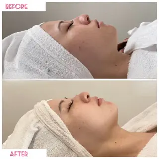 ルイスアディクト 名駅店のエステ・リラクイメージ