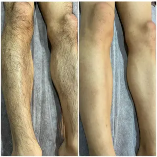 脱毛専門サロン Elixir　加須店のエステ・リラクイメージ