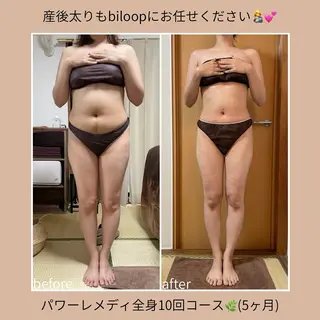 《本気痩せ×疲労改善 》  BILOOPのエステ・リラクイメージ