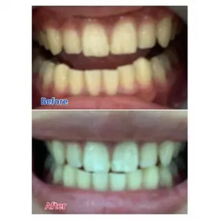 Ｍ渋谷 ホワイトニングのエステ・リラクイメージ