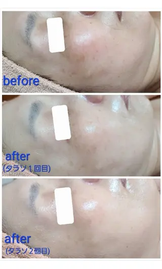 顔ツボ整顔セラピスト 三根百恵のエステ・リラクイメージ