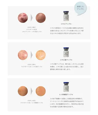 看護師が施術する美容 ナスサロshokoのエステ・リラクイメージ