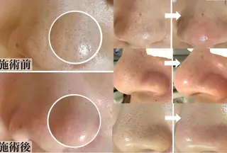 中目黒ハーブピーリン グ🌿ララピールのエステ・リラクイメージ