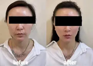 マツエク・マツパ aliaハーブ水光店 エステティシャン募集のエステ・リラクイメージ