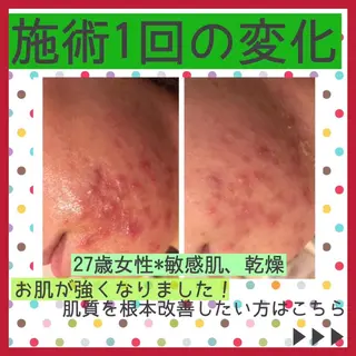 ミディアム カラー パーマ ヘアアレンジ メンズ キッズ ネイル マツエク・マツパ ニキビ・肌質改善専門 ♡人生が変わるサロンのエステ・リラクイメージ