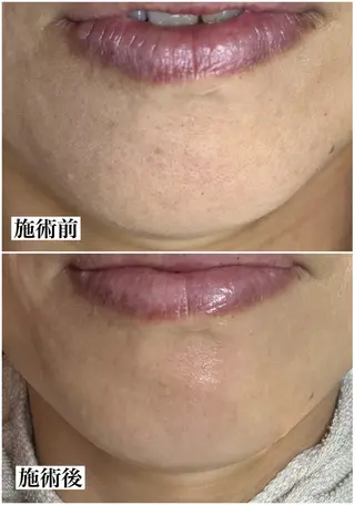 マツヤニWax専門/ 岸和田/Luanaのエステ・リラクイメージ