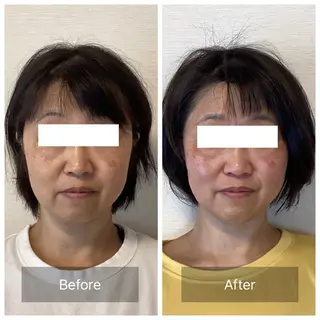 ルコナビューティ所属・小顔・歪み専門　井元 朋子のエステ・リラクイメージ