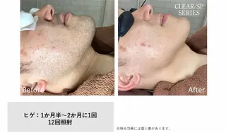 メンズ プライベートサロン Belleのエステ・リラクイメージ