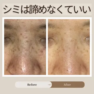 伊藤 稚菜のエステ・リラクイメージ