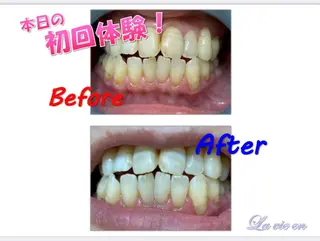 ホワイトニングサロン La vie enのその他イメージ