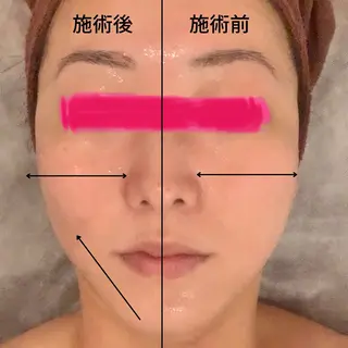 RICHE 【リッシュ】のエステ・リラクイメージ