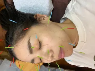 いとう 鍼灸整骨院のエステ・リラクイメージ