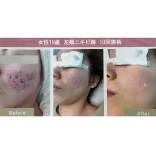 SÉALIE所属・🤍SÉALIE⟡. 脱毛サロン🤍のエステ・リラクイメージ