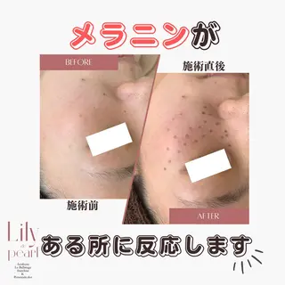 最新シミケアLily de pearlのエステ・リラクイメージ